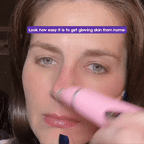Diamond Derm™